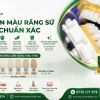 Cách Chọn Màu Răng Sứ Chuẩn Xác Theo Bảng Màu Vita | Mỹ Luân Lab