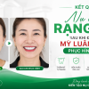 Cách sửa bọc răng sứ hỏng, Mỹ Luân Lab, bọc răng sứ bị viêm lợi, làm lại răng sứ hỏng.