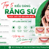 Top 5 Kiểu Dáng Răng Sứ Đẹp Được Giới Trẻ Yêu Thích 2026 | Mỹ Luân Dental Lab