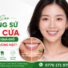 Làm Sao Để Răng Sứ Răng Cửa Không Bị Dài? Bí Quyết Từ Mỹ Luân Lab