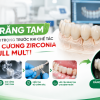 Cầu Răng Tạm Là Gì? Bước Đệm Quan Trọng Trước Khi Làm Răng Zirconia Full Multi