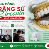 Lab Mỹ Luân – Giải Pháp Gia Công Răng Sứ Zirconia Toàn Diện Cho Nha Khoa