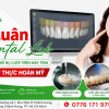 Mỹ Luân Dental Lab – Nơi Biến Bản Thiết Kế Nụ Cười Trên Máy Tính Thành Hiện Thực Hoàn Mỹ