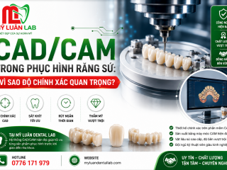 CAD/CAM Trong Phục Hình Răng Sứ | Công Nghệ Nha Khoa Hiện Đại