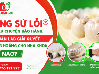Răng Sứ Lỗi Và Câu Chuyện Bảo Hành: Mỹ Luân Lab Giải Quyết Khủng Hoảng Thế Nào?
