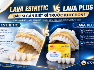 Răng Sứ Lava Esthetic & Lava Plus: Khác Biệt Bác Sĩ Cần Biết