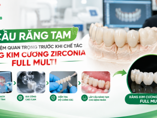 Cầu Răng Tạm Là Gì? Bước Đệm Quan Trọng Trước Khi Làm Răng Zirconia Full Multi