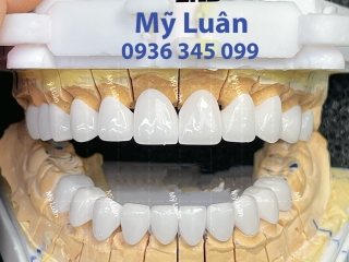 Phục Hình Răng Sứ Zirconia