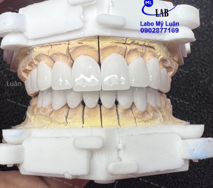 Chúc  mọi người đầu tuần nhiều năng lượng. Form vuông cá tính cho bệnh nhân nam.