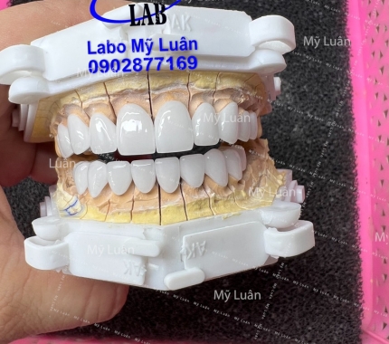 Trắng trong tự nhiên nha mọi người, sứ DDBIO.