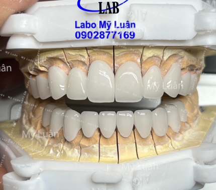 Một hàm thẩm mỹ phải gọi là siêu phẩm, form dáng quá ok nha mọi người.