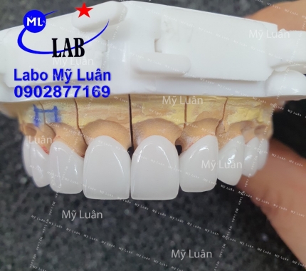 Em chuẩn bị gởi đến bác sĩ  hi. Chúc mọi người cuối tuần vui vẻ nha.