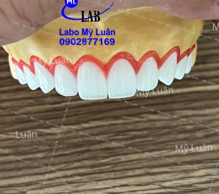 Trả lại răng đẹp cho quý khách hàng. hi