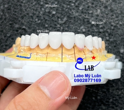 Màu siêu trắng luôn nha quý khách hàng ơi. Đáp ứng nhu cầu của khách hàng luôn là  tiêu chí  của chúng tôi.
