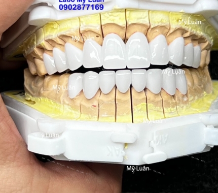 Siêu trắng luôn nha quý khách hàng ơi. Còn chần chờ gì nữa mà không đến với chúng tôi để trãi nghiệm cái  đẹp.