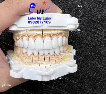 Màu trắng nhiều luôn nha quý khách hàng ơi. Thứ 6 vui vẻ hihi.