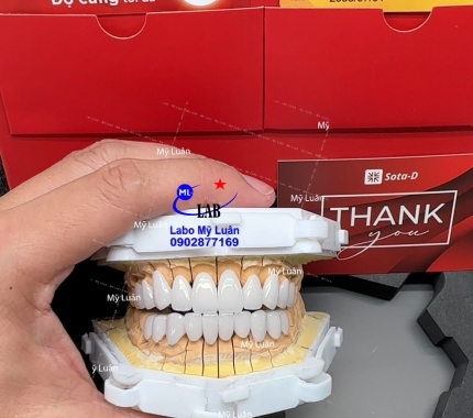Đặt niềm tin vào Labo Mỹ Luân chúng tôi , bạn có một Đối Tác Tâm Huyết luôn sáng tạo những giới hạn cao nhất. Đây là dòng sứ Lava Plus