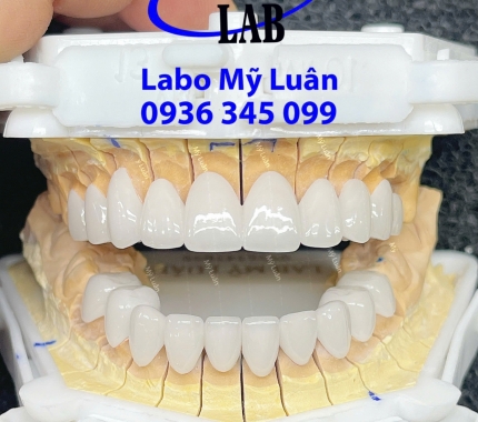 Bạn hãy nhìn và cảm nhận như thế nào ? Còn riêng tôi thì chỉ thốt lên 2 chữ " TUYỆT VỜI".