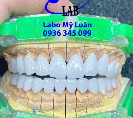 Để sở hữu một nụ cười rạng ngời thật không khó. Đến với chúng tôi những điều không thể sẽ thành có thể.
