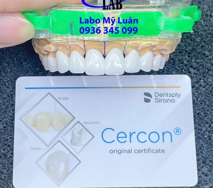 Cercon HT Là một trong những dòng sứ cao cấp bậc nhất và khách hàng đang rất ưa chuộng.