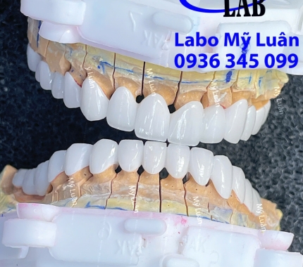 Mổi một ngày là một điều mới mẽ, bên cạnh đó LAB MỸ LUÂN mổi một ngày tạo ra thêm 1 sản phẩm.