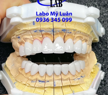 Khi bạn tự tin với nụ cười thì cuộc sống vui tươi và mọi điều tốt đẹp sẻ đến với bạn. Chúc các bạn có 1 ngày cuối tuần tràn đầy hạnh phúc.