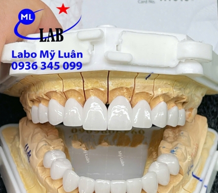 Thứ bảy một ca siêu phẩm đến từ thương hiệu HT SMILE.