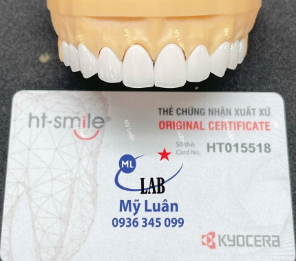 Răng mẫu HT SMILE dòng sứ cao cấp đang được khách hàng quan tâm và lựa chọn.