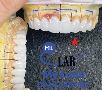 Siêu phẩm được LAB MỸ LUÂN tạo ra mỗi ngày.