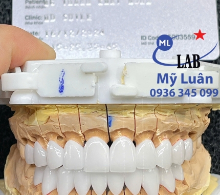  VENUS là dòng sứ cao cấp được khách hàng quan tâm từ trước đến thời điểm hiện tại.