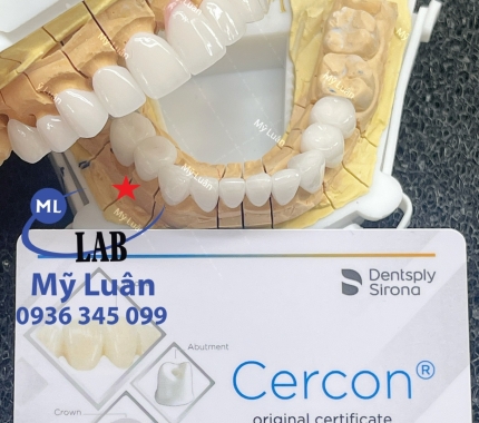 Lại thêm 1 hàm Cercon HT trắng sáng nha mọi người !
