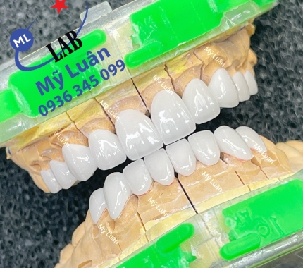 Một cười trắng sáng sẽ tạo nên sự tự tin cho bạn