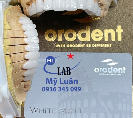 Orodent White Matt là 1 trong những dòng sứ cao cấp nhất thị trường.