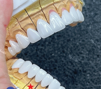 Lab Mỹ Luân vừa cho ra một sản phẩm mới,khách hàng có thể tham khảo