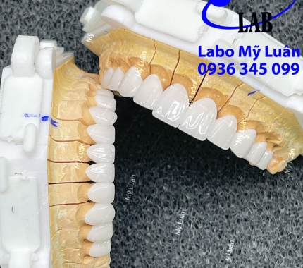 Thêm một sản phẩm mới đến từ Lab Mỹ Luân đây ạ