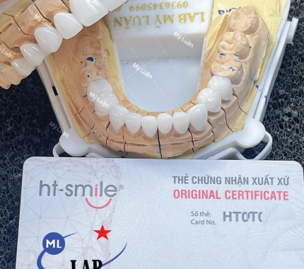 Lại thêm một ca HT SMILE trắng sáng được khách yêu tin tưởng và lựa chọn