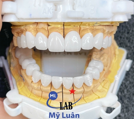 Tinh tế đến từng chi tiết đã tạo ra một kiệt tác.