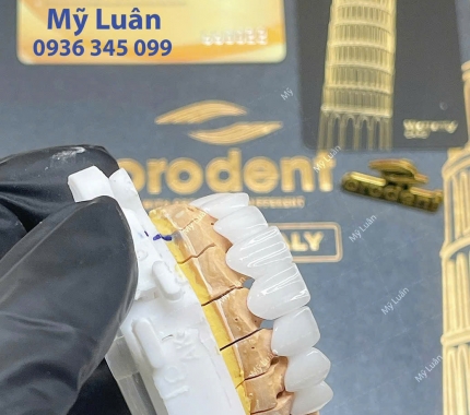 ORODENT BLEACH INNOVATION Limited Edition.
