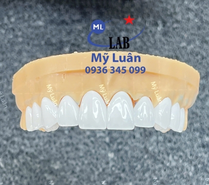 Hàm mẫu tư vấn xịn sò dành cho Nha Khoa.