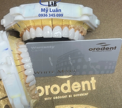 Orodent White Matt dòng sứ cao cấp nhất hiện tại.