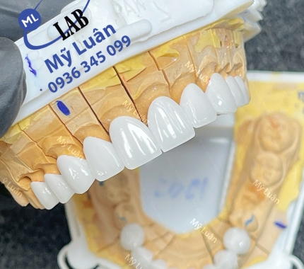 Quá nét cho sản phẩm siêu trắng trong, xinh lung linh.