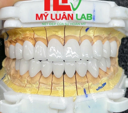 Liên tiếp sản phẩm mới được LAB MỸ LUÂN cho ra đời hoàn hảo.